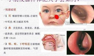 5岁孩子鼻窦炎怎么办